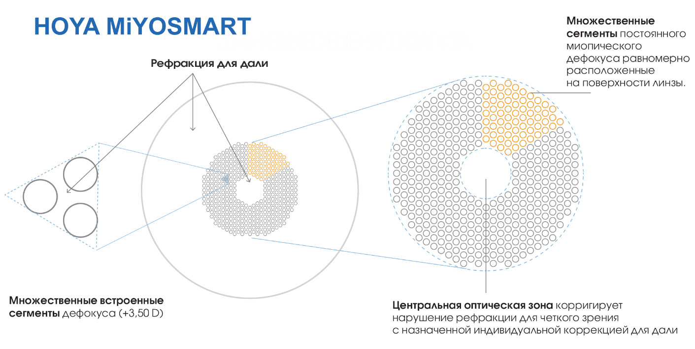 линзы для очков Miyosmart