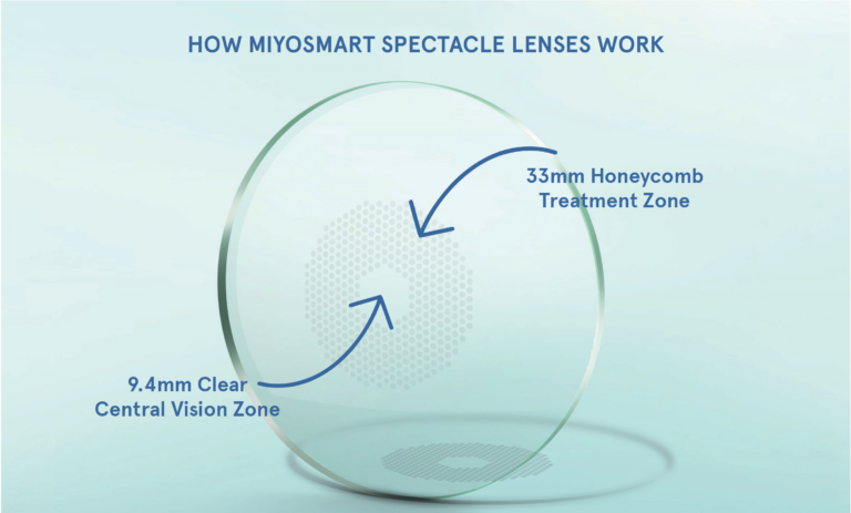 Линзы Hoya Miyosmart